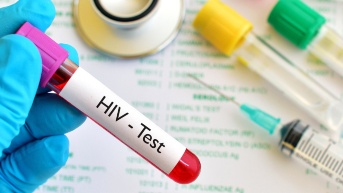 fotografía Referencial VIH (Internet)