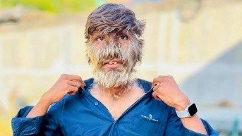 Fotografía de Lalit Patidar. (Internet.)