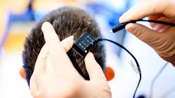 Momento en el que los investigadores conectan el implante cerebral a la computadora sintetizadora de voz. (EFE)