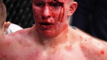 Mark Vologdin, peleador ruso luego de perder contra Adrián Luna. (UFC)