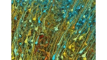 Representaciones de D. Berger en la Universidad de Harvard. (Google Research y Lichtman Lab, Universidad de Harvard.)