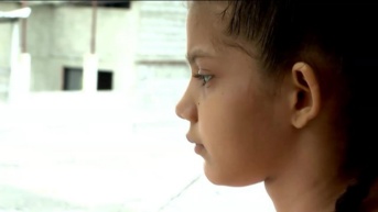 Imagen de una niña paciente de una enfermedad rara. (Televistazo)