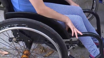 Imagen de una paciente con una enfermedad rara. (Televistazo)