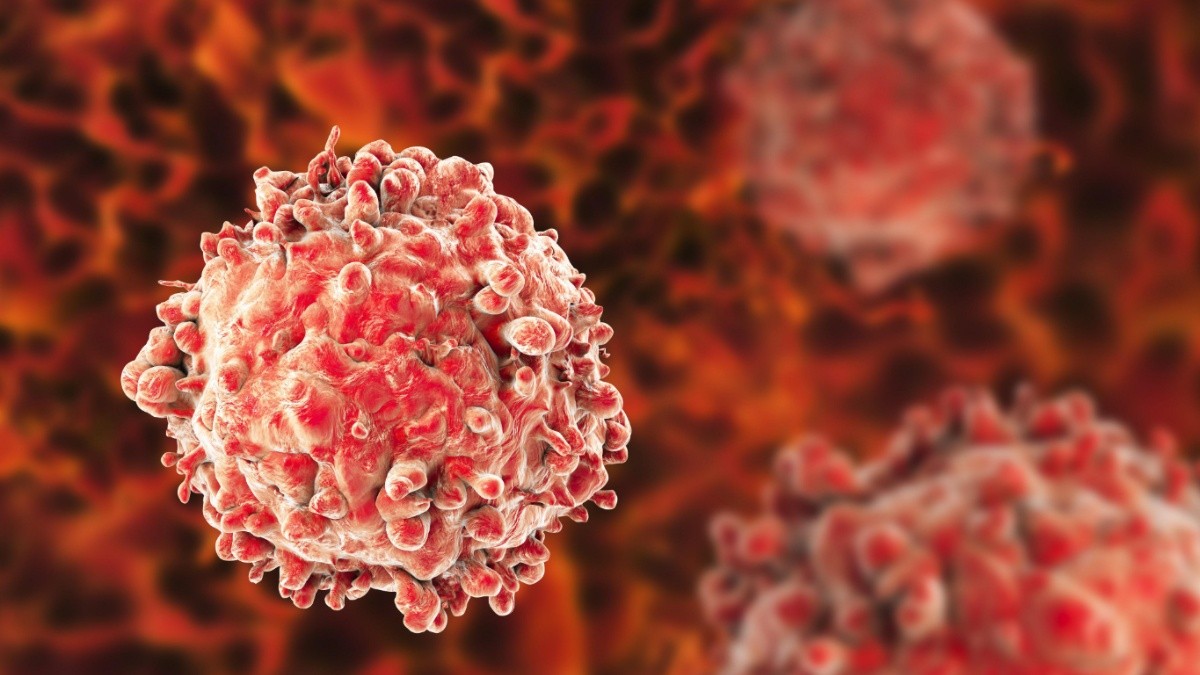 Foto referencial (Medline Plus)