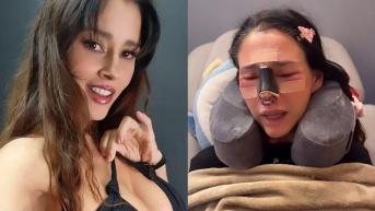 Dorismar, antes y luego de la fallida rinoplastia. (RRS)