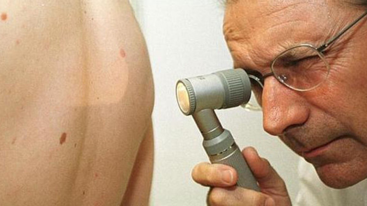 El dolor y el picor en lesiones cutáneas pueden ser una señal de alarma para el cáncer de piel