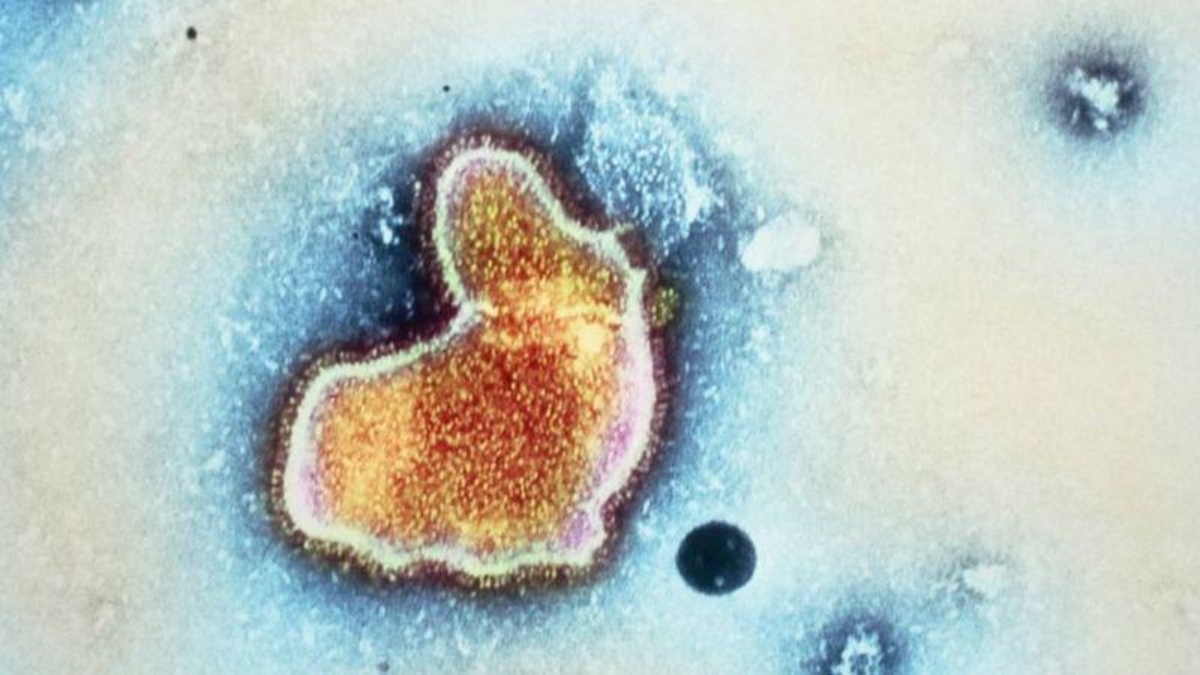 Imagen del Virus Respiratorio Sincitial o VRS. "Sincitial" se refiere a que el virus destruye membranas celulares por lo que se forman masas con numerosos núcleos celulares llamadas "sincicios". (GETTY IMAGES)