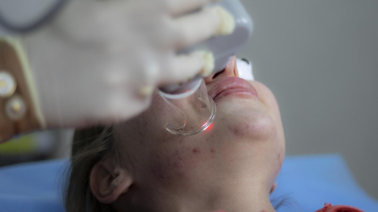 El uso de la Inteligencia Artificial en la piel. (Pixabay - Referencial)