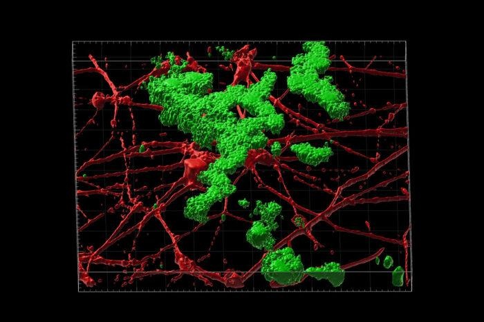 Reconstrucción en 3D de la deposición de placas de beta amiloide (verde) entre neuronas (rojo) cultivadas en el laboratorio. (EFE)