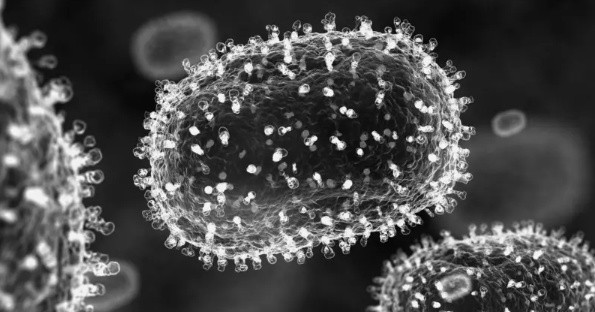 Así es el virus que causa la mpox visto en el microscopio. (SPL)