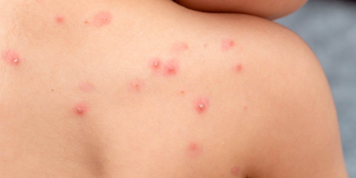 Imagen referencial. (Internet)